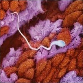 一個(gè)精子在輸卵管粘膜皺褶內(nèi)向前游走